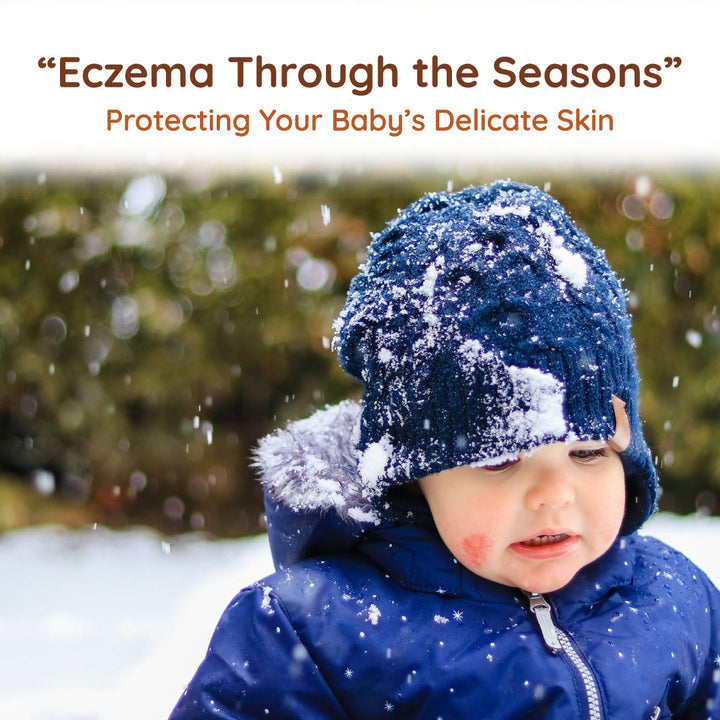 How The Seasons & Climate Affect Your Baby's Eczema ?